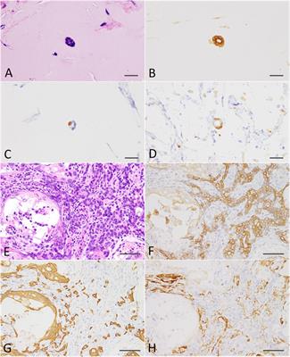 The Unique Genetic and Histological Characteristics of DMBA-Induced Mammary Tumors in an Organoid-Based Carcinogenesis Model